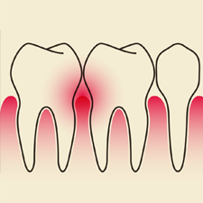 Dental Research from the Body Farm - Dental Bone Disease course image